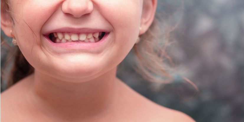 Tratamientos de restauración dental con fines estéticos