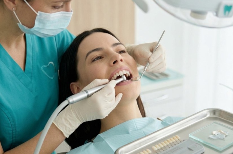 Qué son las carillas dentales